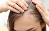 وقتی هورمون‌ها به موها حمله می‌کنند؛ راز ریزش مو در PCOS چیست؟